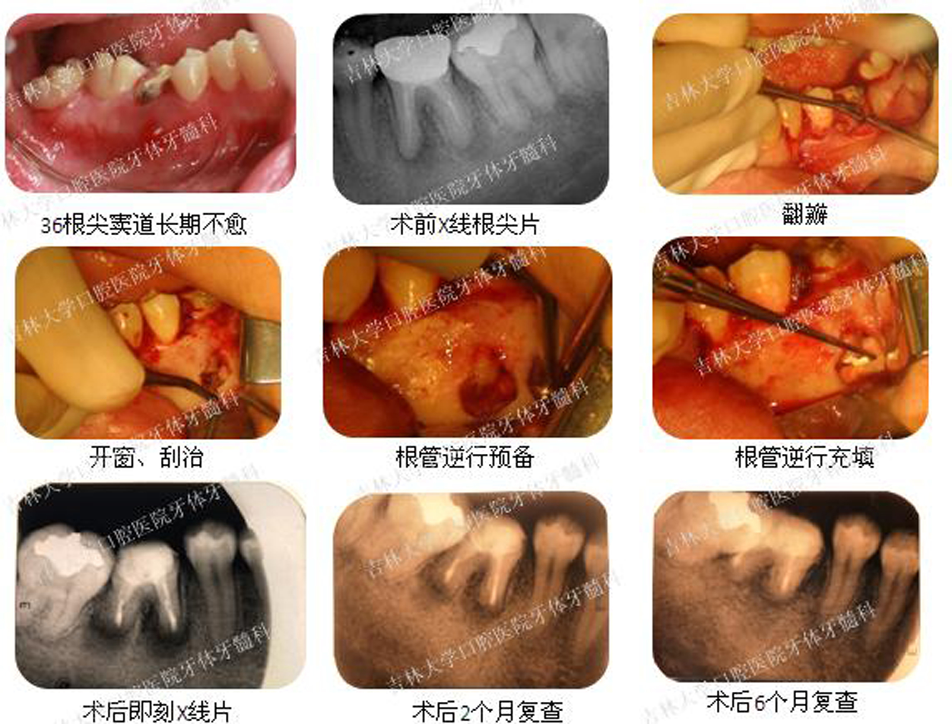 微创小根管 显微大世界——牙体牙髓科特色医疗